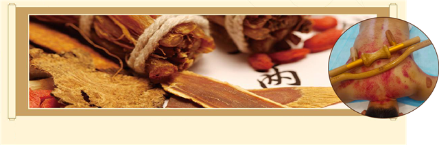 特色中醫(yī)傳承——藏醫(yī)扡棍診療