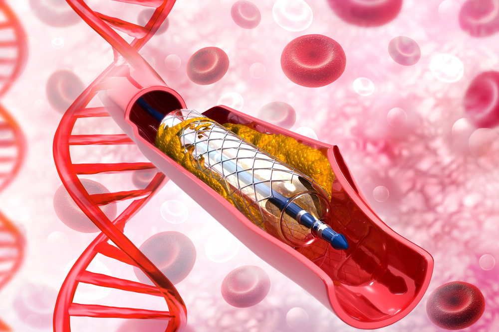 “心髒支架難救命”幹細胞才是(shì)心血管疾病的(de)“強大(dà)補丁”！