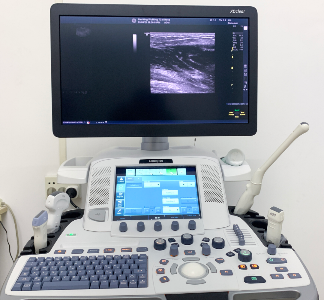 美(měi)國(guó)GE LOGIQ E9彩色超聲診斷儀——臨床診療出色的(de)“偵察兵(bīng)”