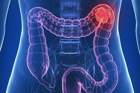 影(yǐng)響你(nǐ)免疫系統的(de)冷(lěng)知(zhī)識！從(cóng)“大(dà)便”開(kāi)始識别腸道(dào)微(wēi)生(shēng)态