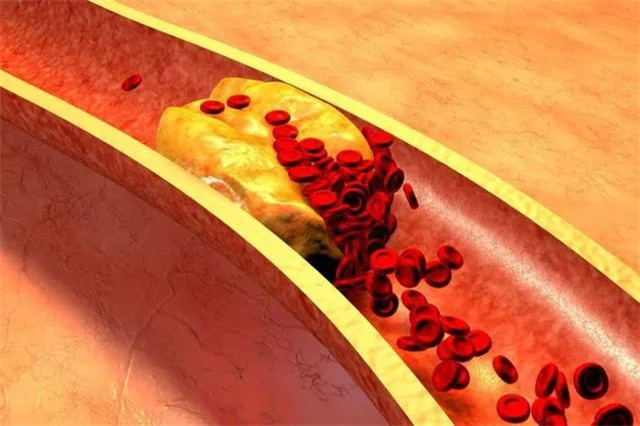 血脂異常≠高(gāo)血脂！你(nǐ)的(de)血脂在這(zhè)個(gè)範圍內(nèi)才正常！